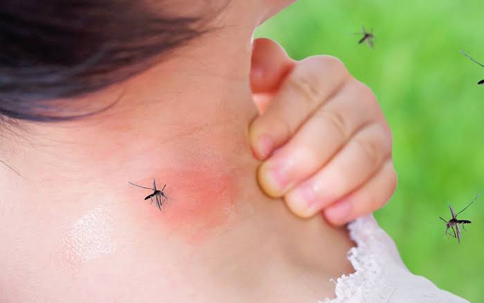 Mosquito bite